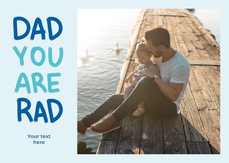 You Are Rad Card